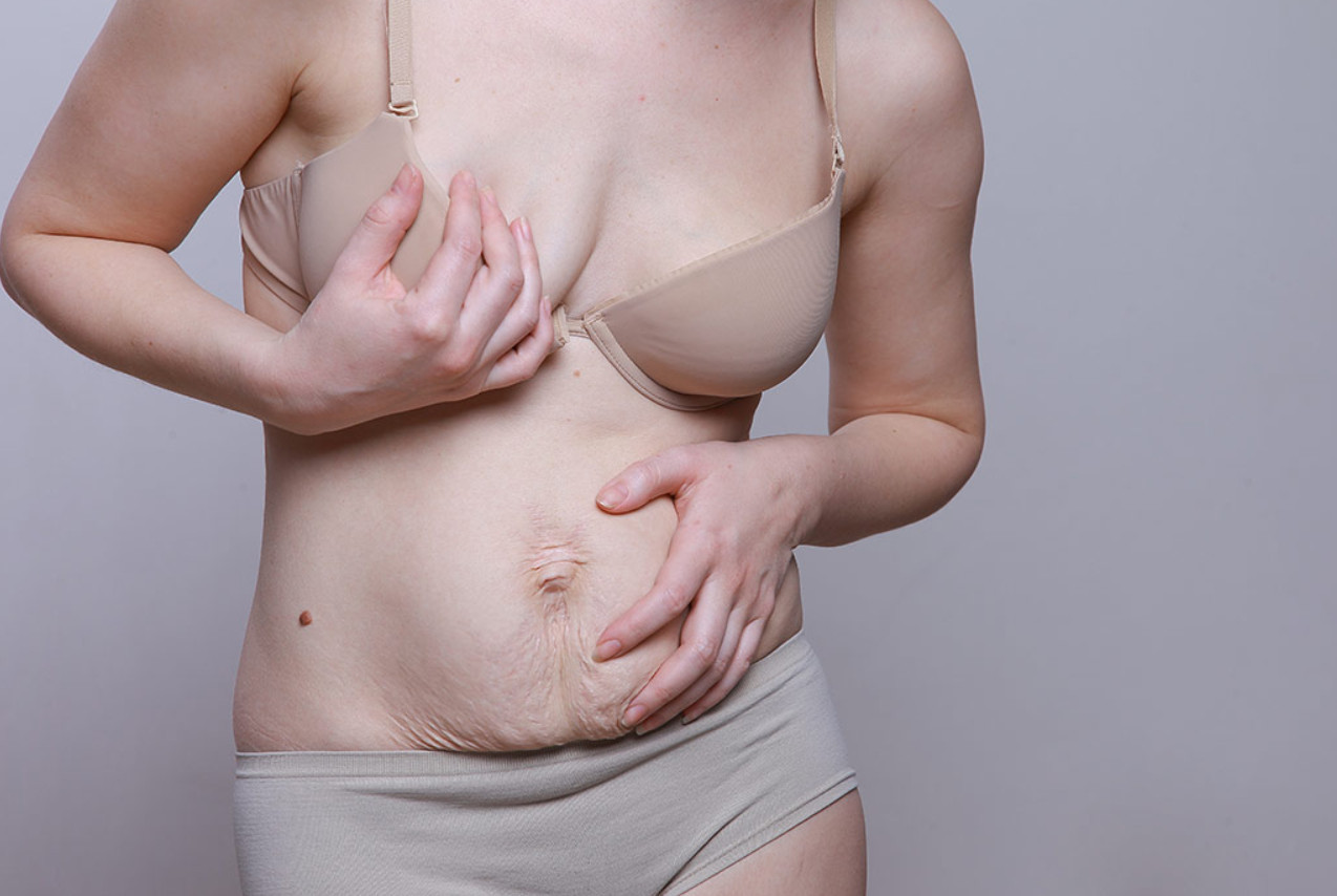 грудь при беременности кожа фото 34