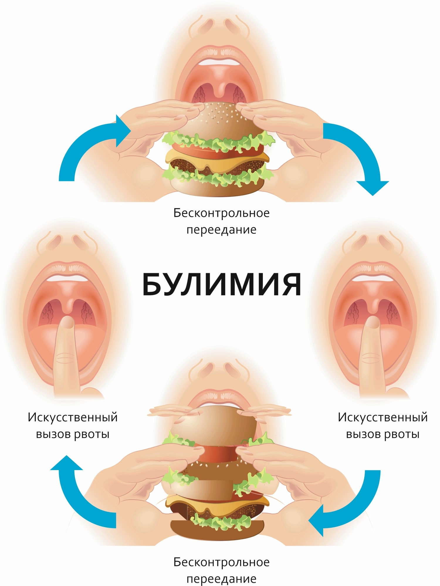 Нервная булимия картинки