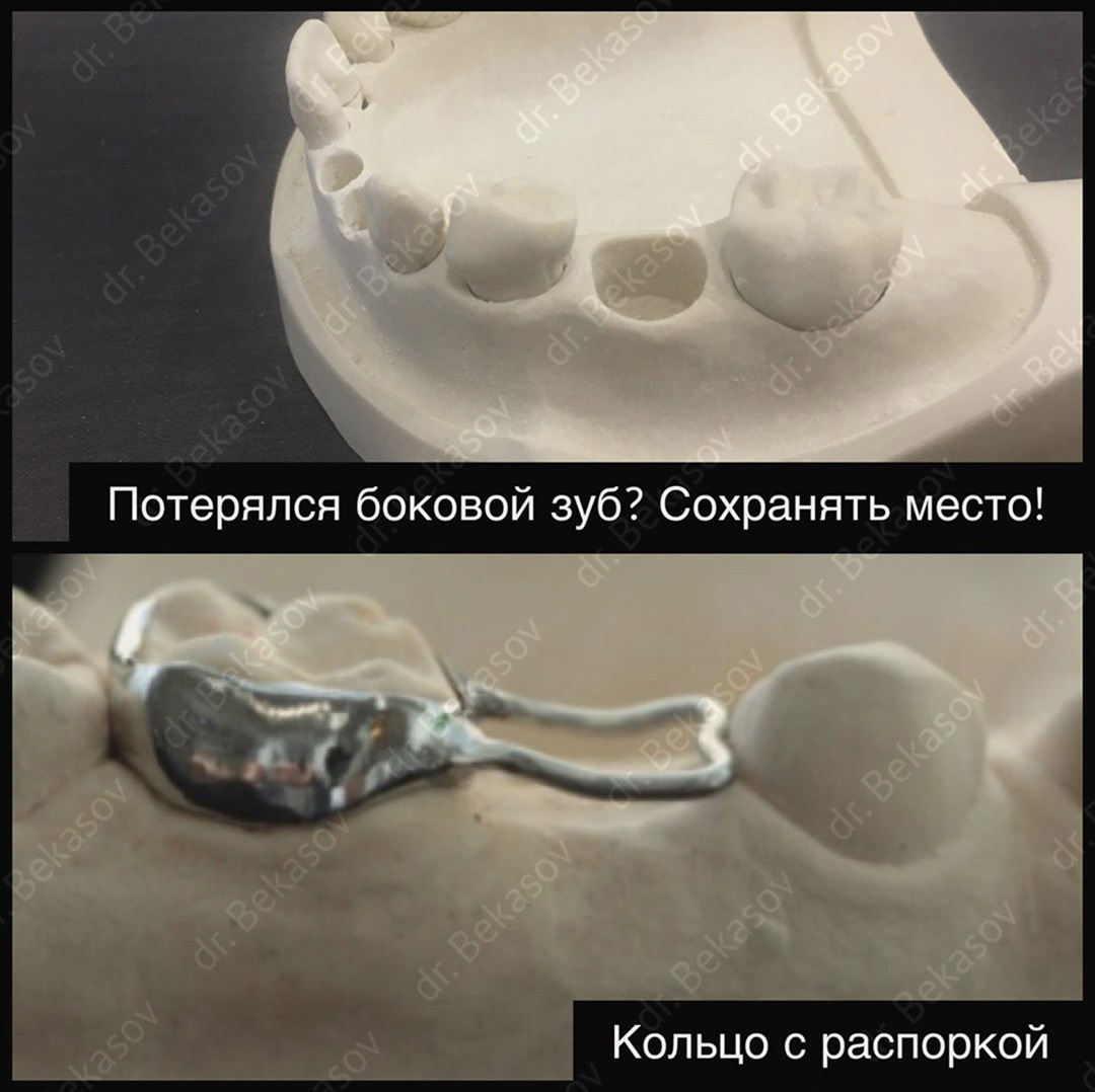 молочные зубы фото вырванных