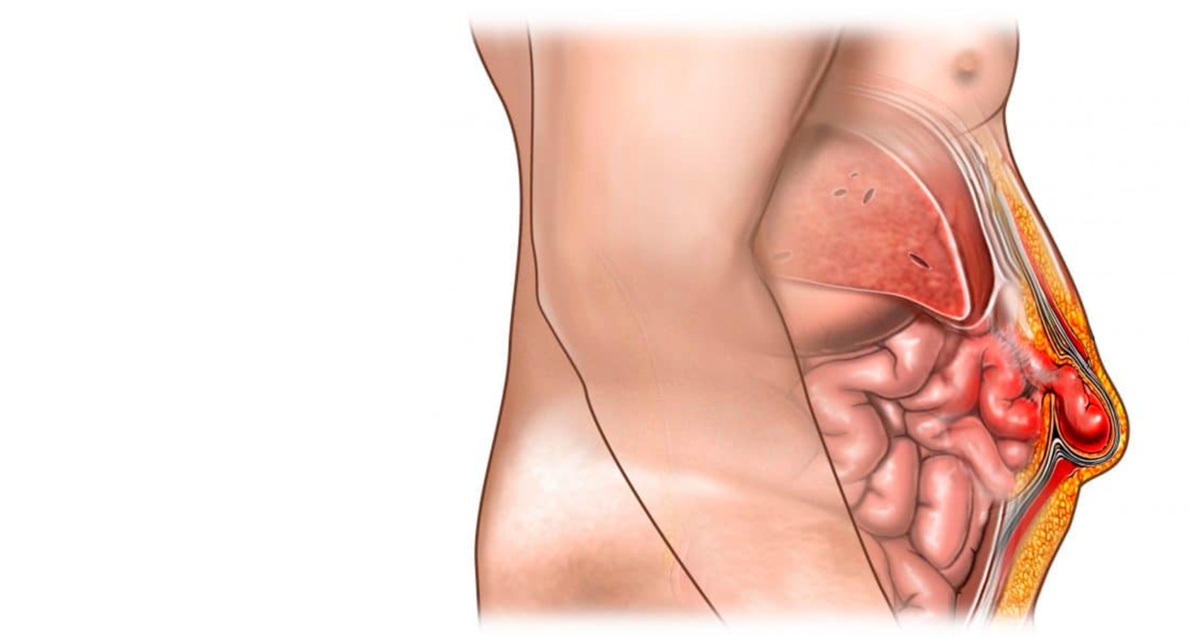 Rückenschmerzen prostata