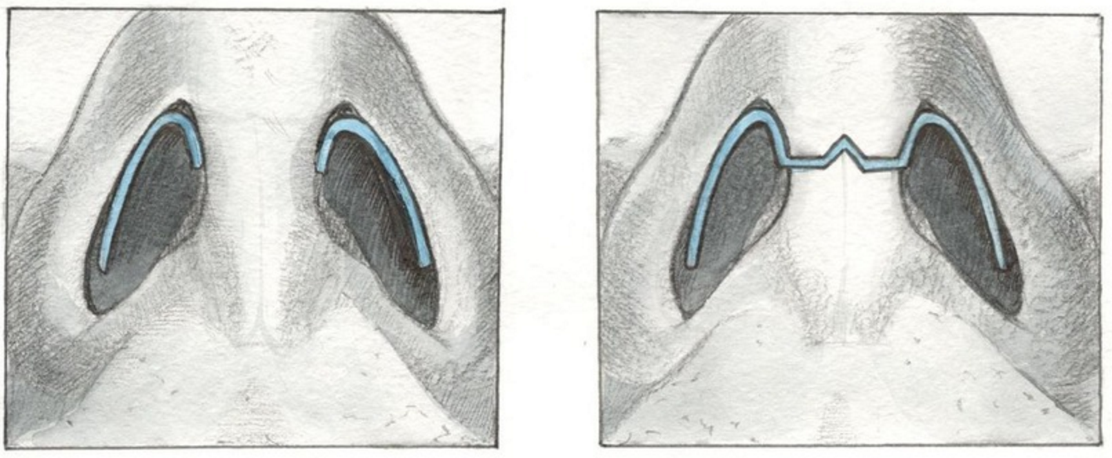 Техника операции