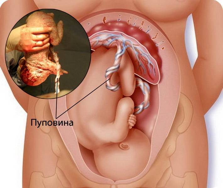 Ребенок в утробе писает. Ребенок с пуповиной в животе. Плацента и пуповина после родов.