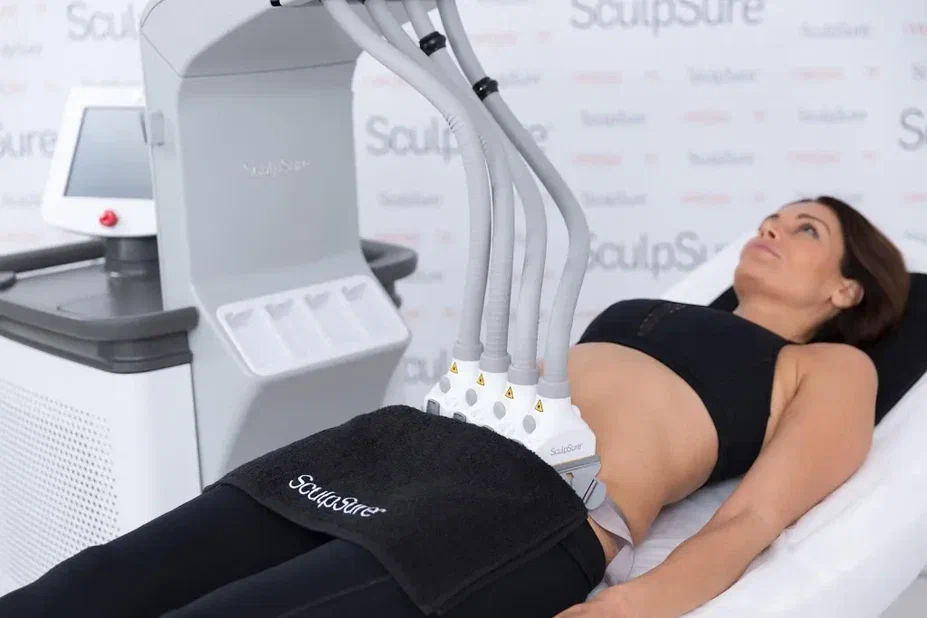 SculpSure, фото 2