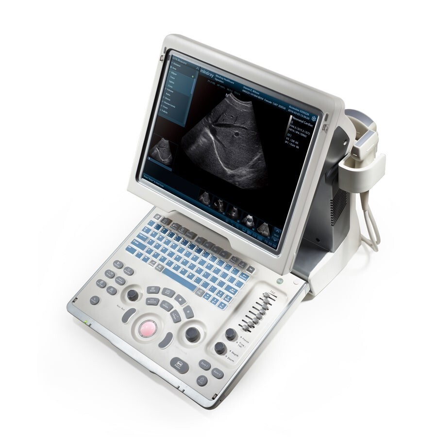 Аппарат УЗИ Mindray DP-50 2