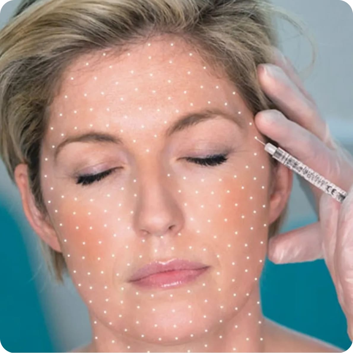 Биоревитализация lj b gjckt. Биоревитализация lj b gjckt. Лицо до и после биоревитализации. Рекомендации после биоревитализация лица. Техника наппаж мезотерапия.