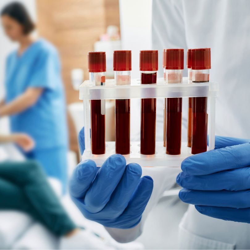 Anemia