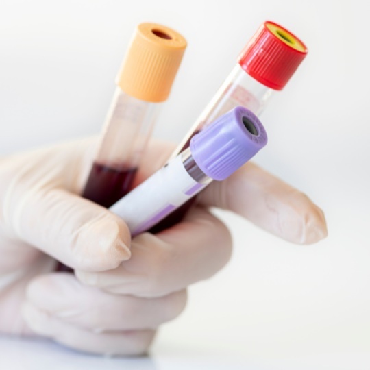 Dengue Test — Dengue test: CBC + NS1 (Nurse)