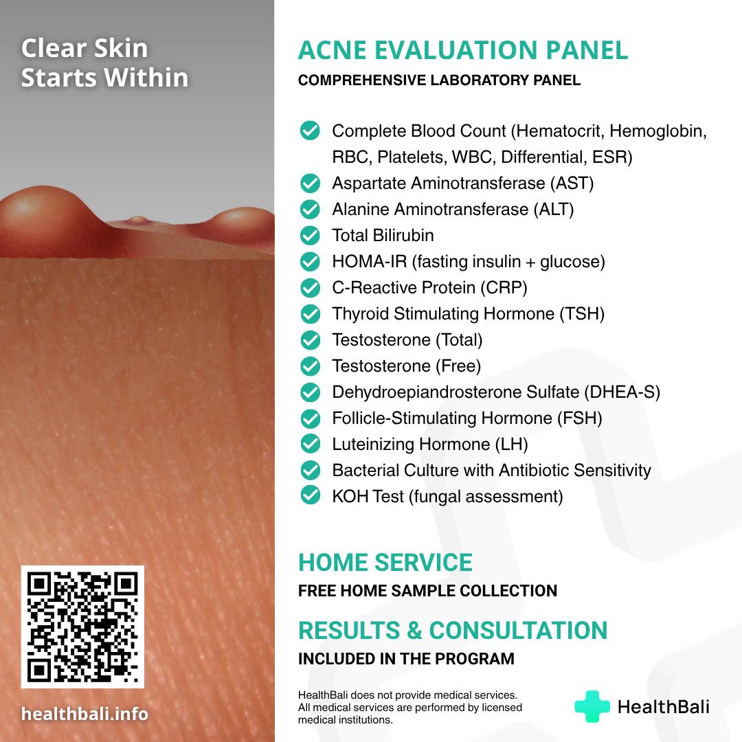 Acne Assessment