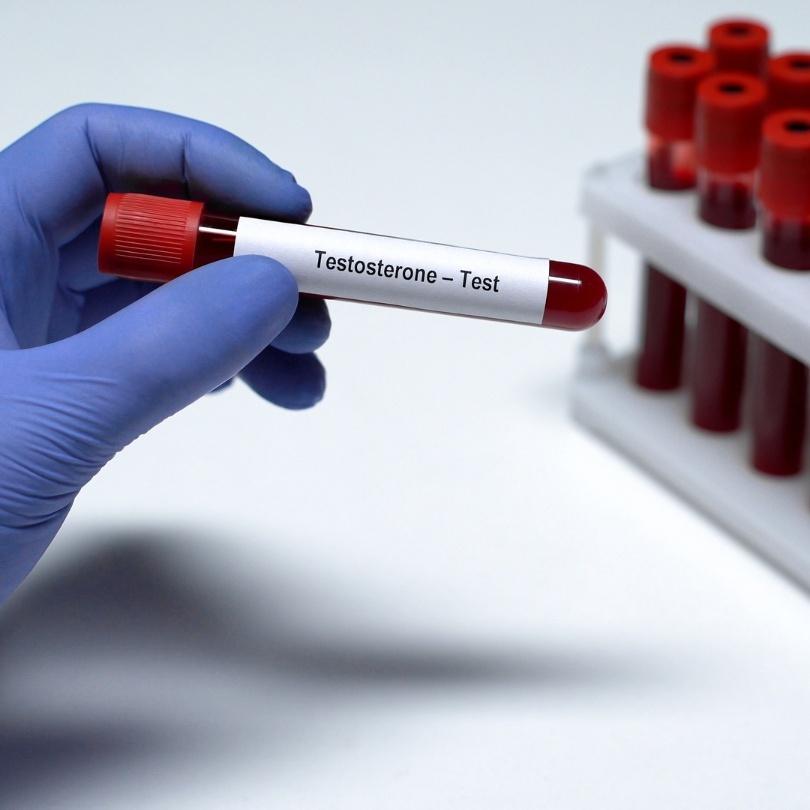 Testosterone status – What's included