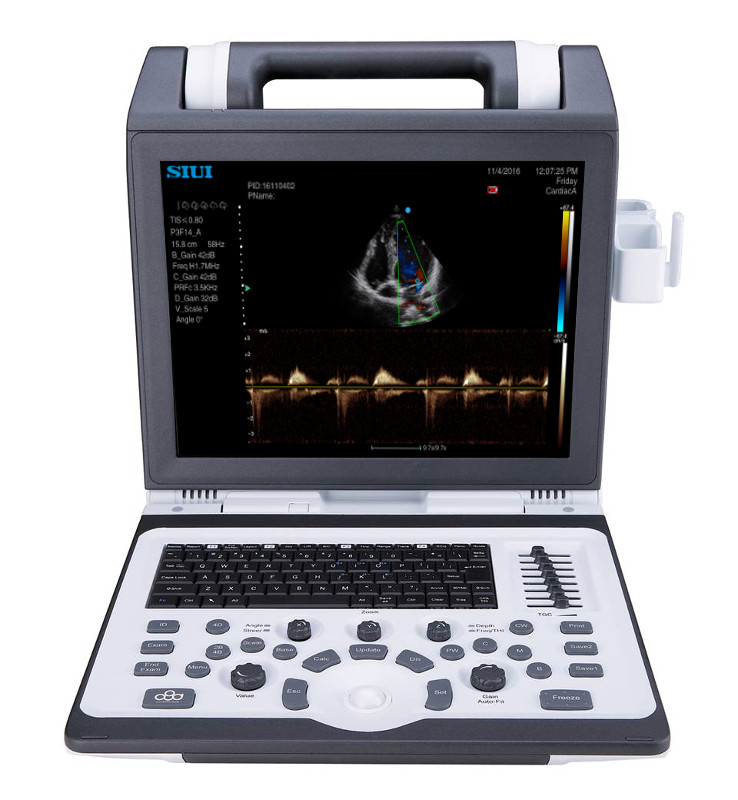 Аппарат УЗИ SIUI Apogee 1100 2