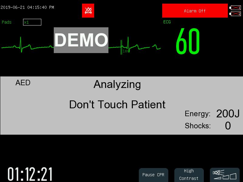 Дефибриллятор-монитор Comen S8 10