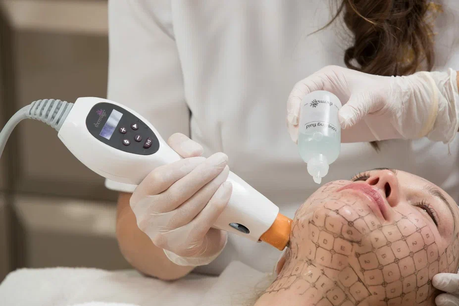 Treatment Tip Thermage CPT