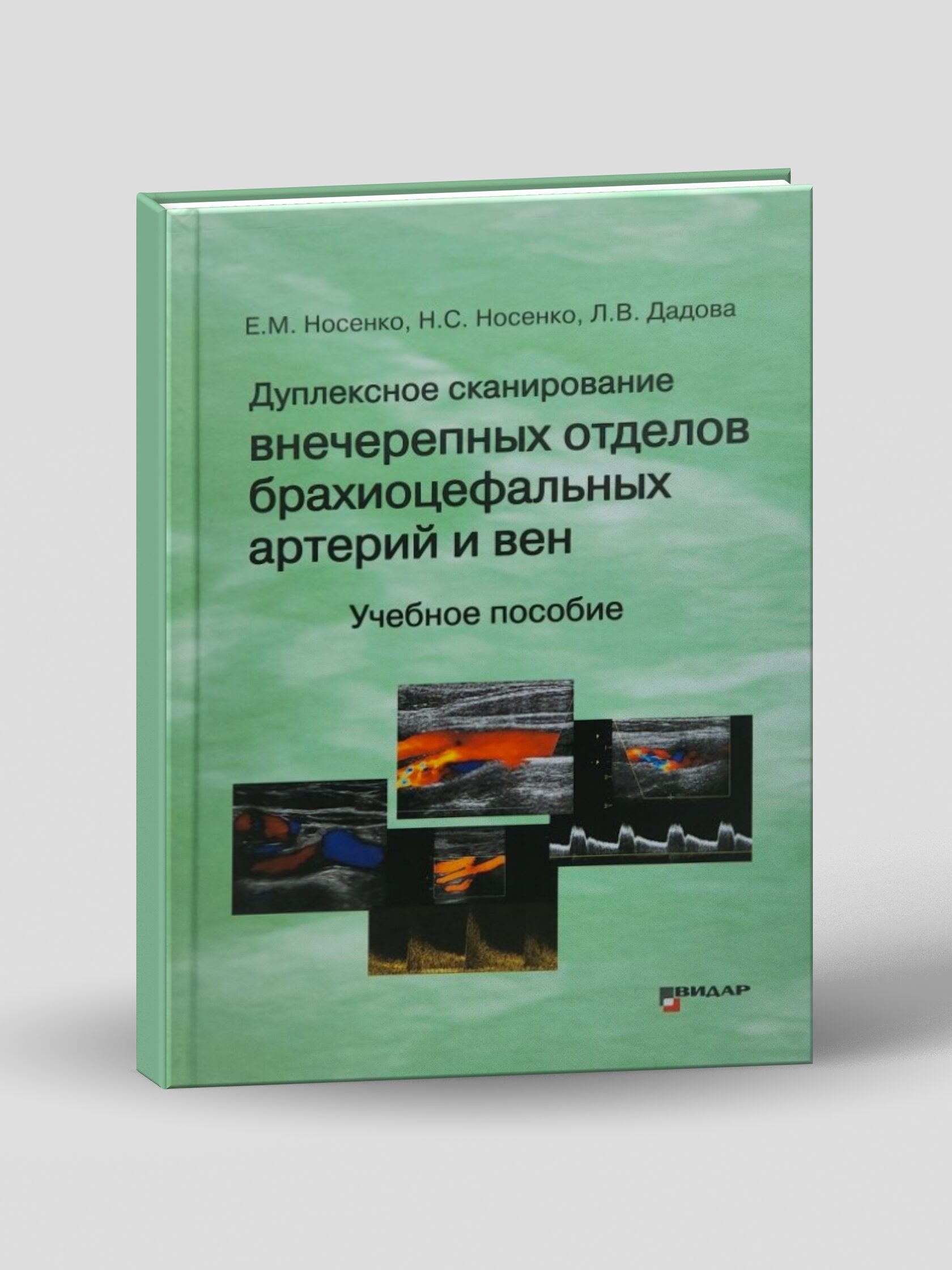 Дуплексное сканирование внечерепных отделов брахиоцефальных артерий