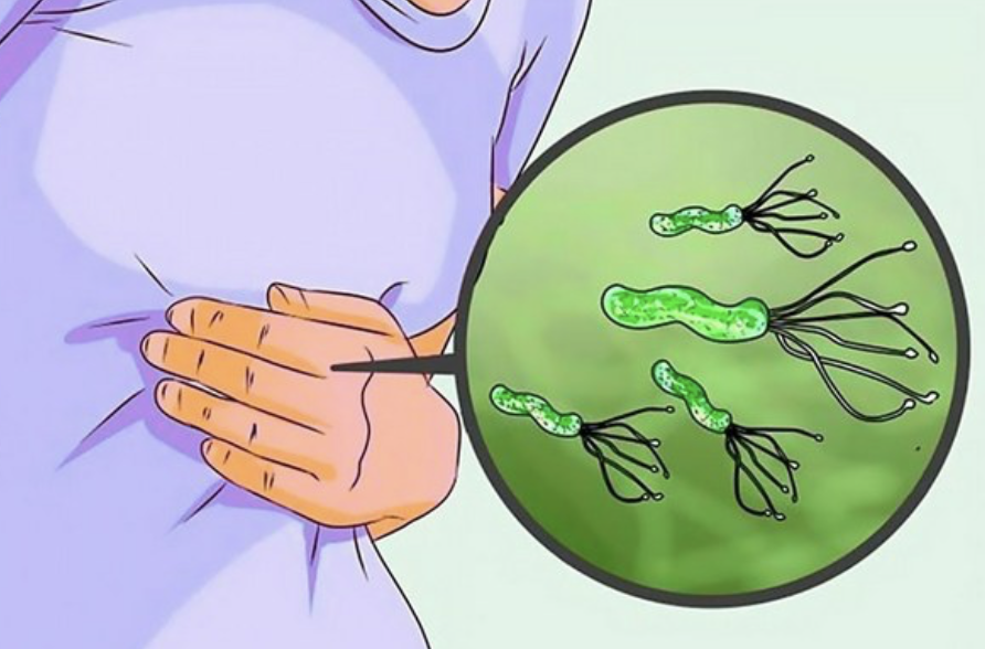Уреазный тест на Helicobacter pylori