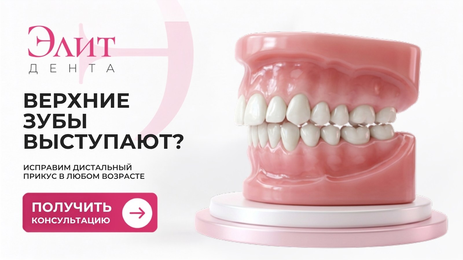 Модель челюсти с дистальным прикусом — верхние зубы выступают вперёд