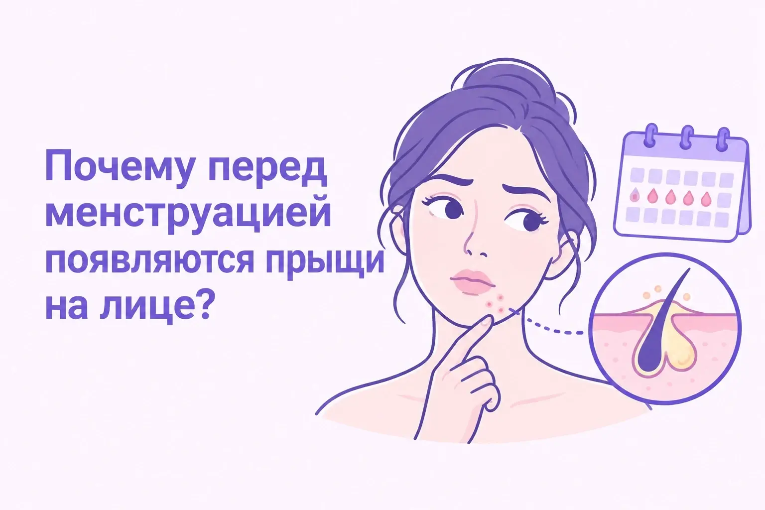 Почему перед месячными появляются прыщи на лице?