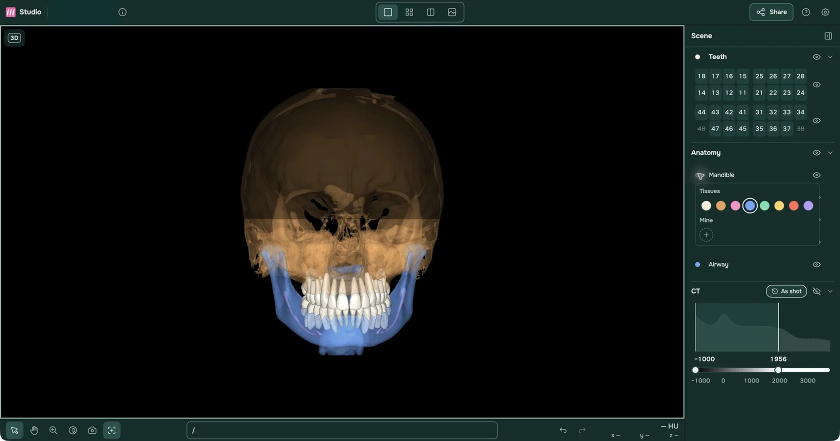 Select anatomy. Adjust color and opacity. See what matters.