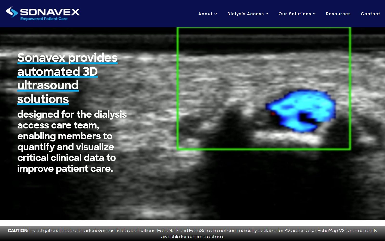 Sonavex homepage screenshot (October 2026)