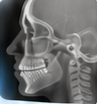 xray