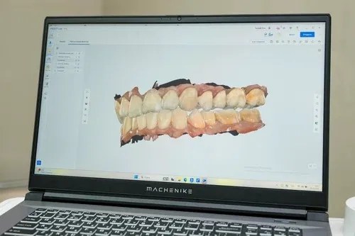 3D-модель зубов на экране компьютера