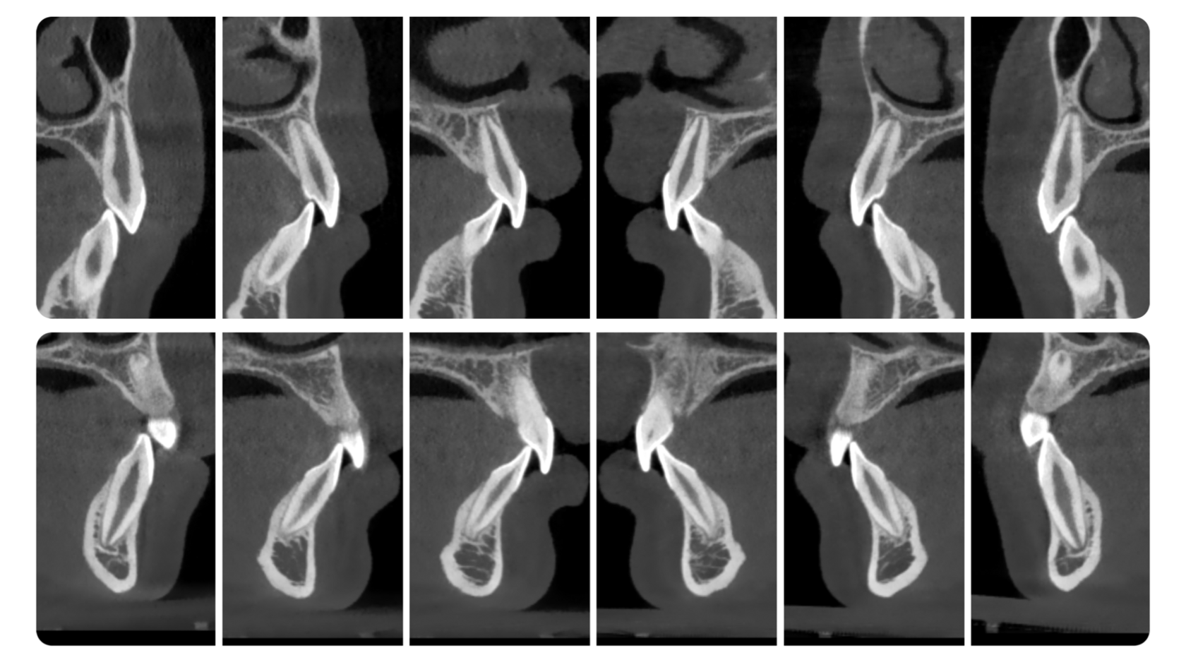 Tooth-centered sagittal slices