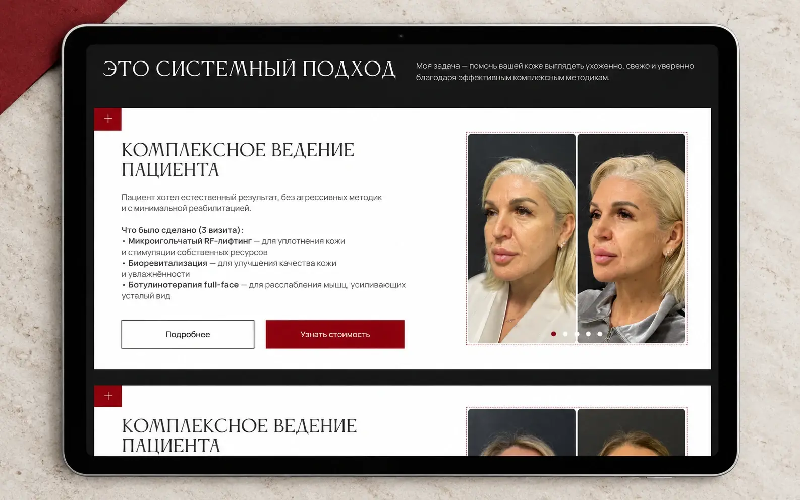 История комплексного ведения пациента с фотографиями до и после