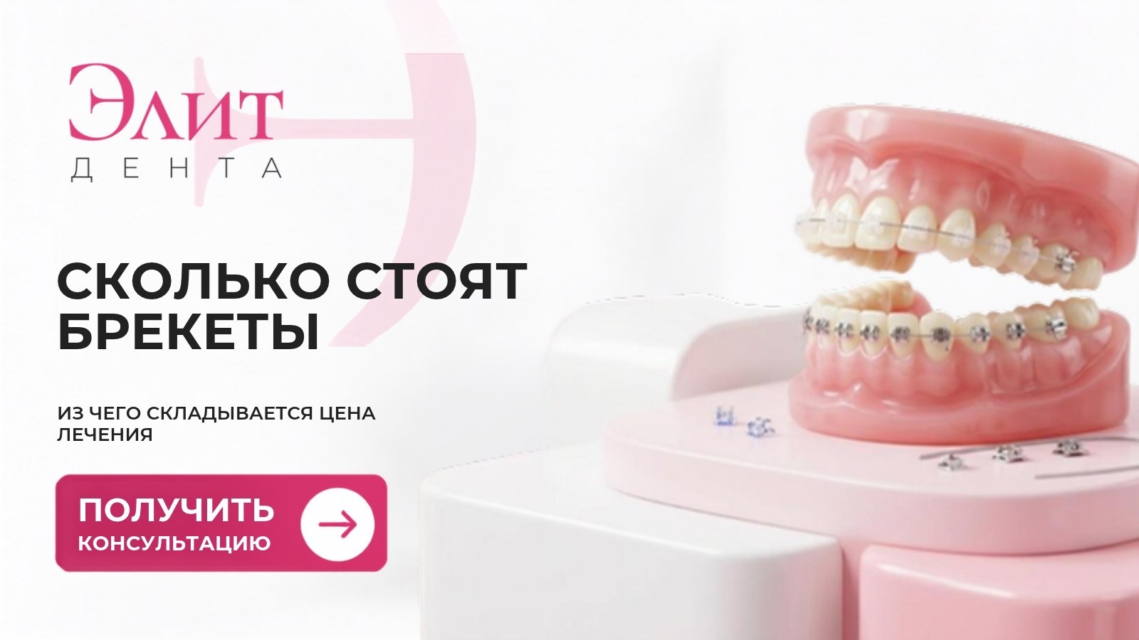 Модель челюстей с металлическими и керамическими брекетами
