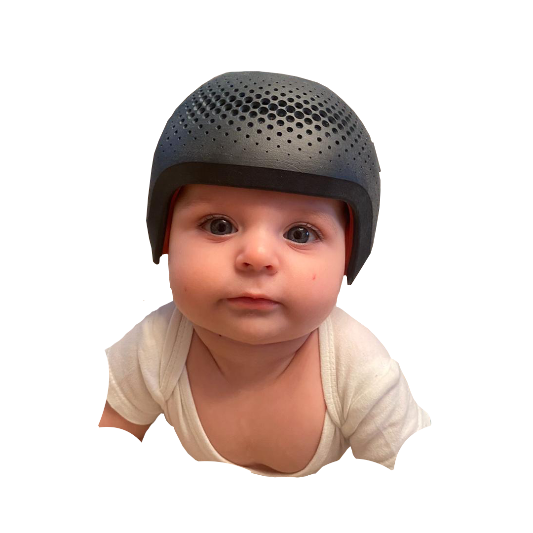 Ортопедический шлем — доказательная медицина