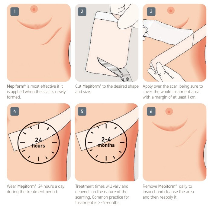 инструкция по применению мепиформ