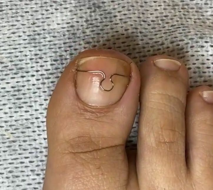 Медицинский педикюр обучение онлайн