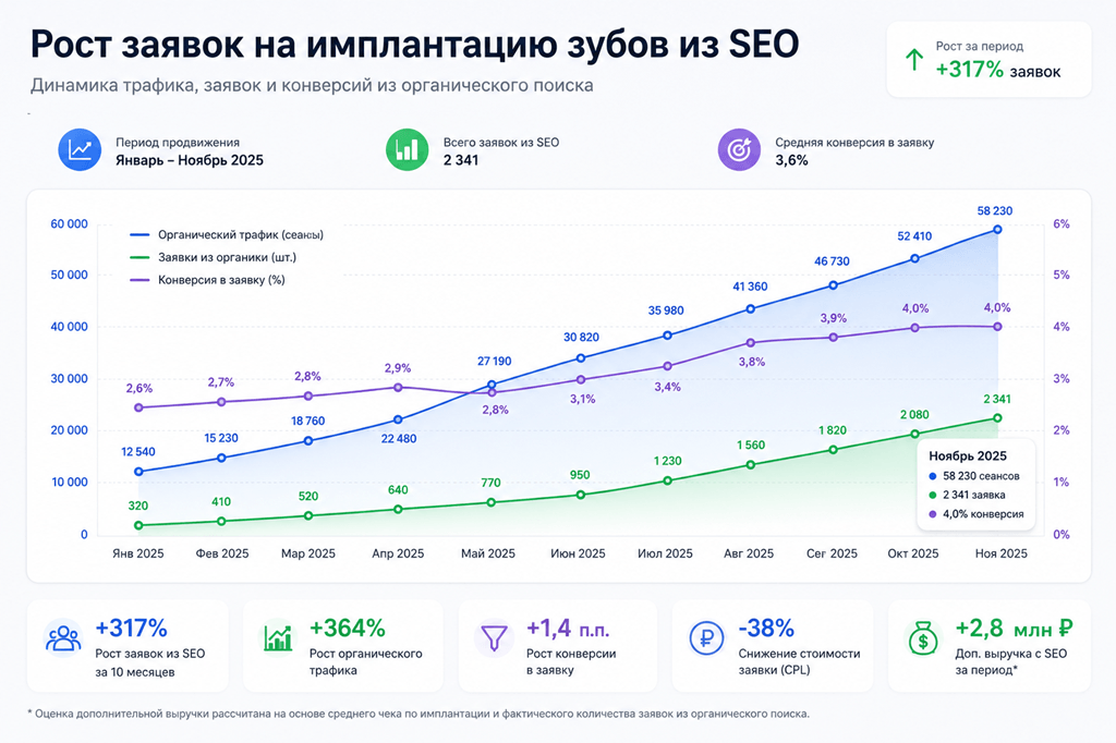 Рост заявок на имплантацию зубов из SEO