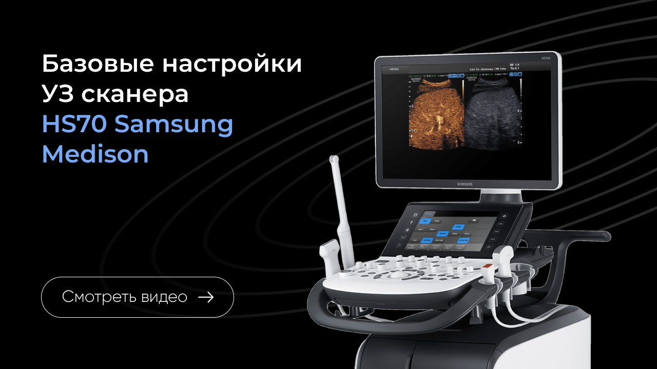 Базовая настройка УЗ сканера Samsung HS70
