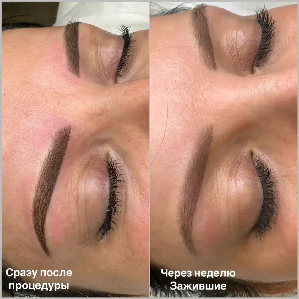 Брови
