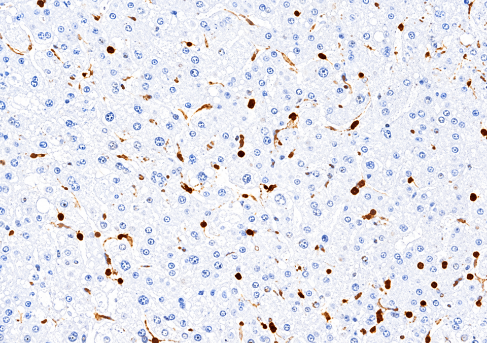 Недостаточное окрашивание CD45 в печени