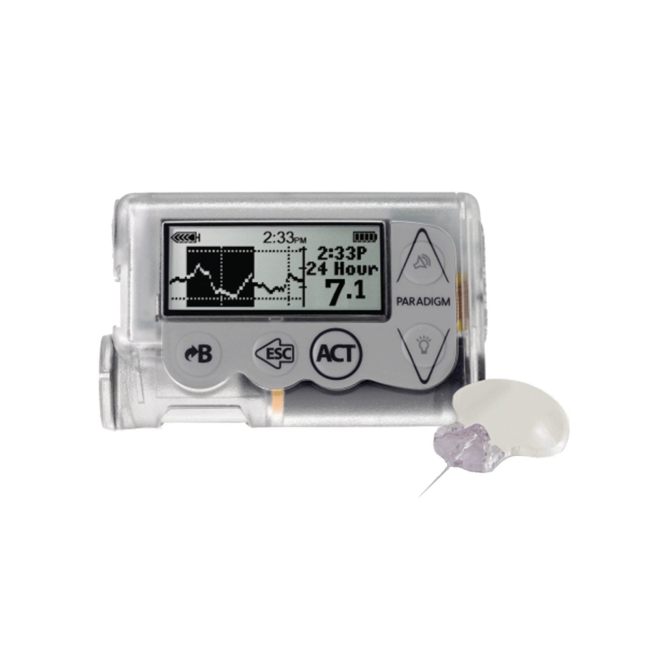 Помпа медтроник. Помпа Медтроник 754. MINIMED Paradigm veo ММТ 754, Medtronic. Инсулиновая помпа MINIMED Paradigm ММТ-722. Помпа Медтроник 722.