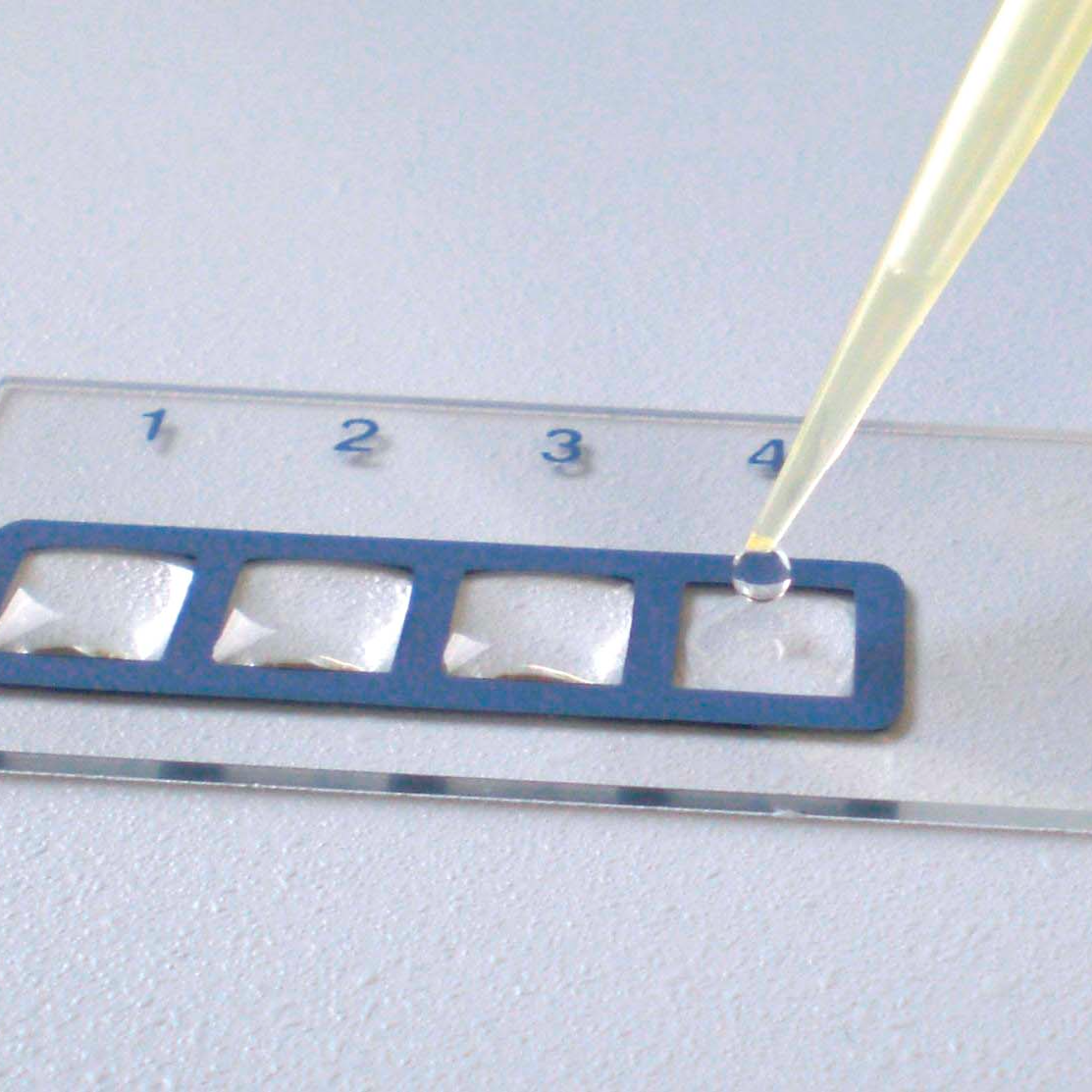 Метод иммунокап. Аллергочип IMMUNOCAP Isac. Аллергодиагностика IMMUNOCAP.. Isac 112 аллергокомпонентов. Аллергочип alex2.