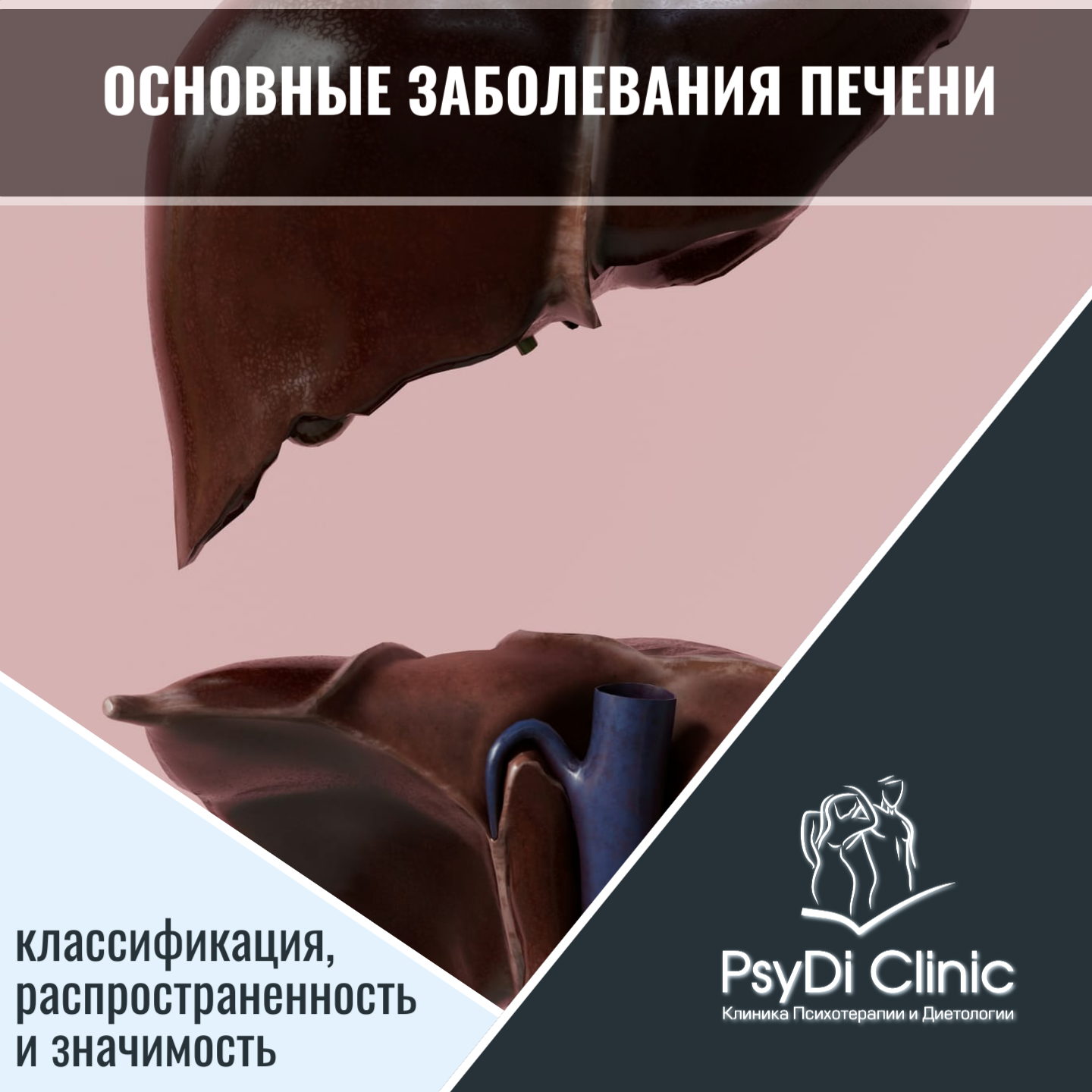Основные заболевания печени: классификация, распространенность и значимость