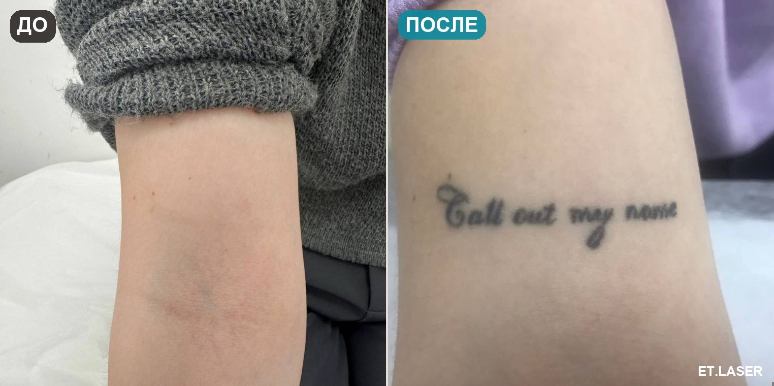До и после: надпись на руке