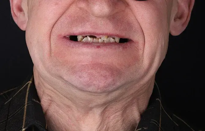 До лечения