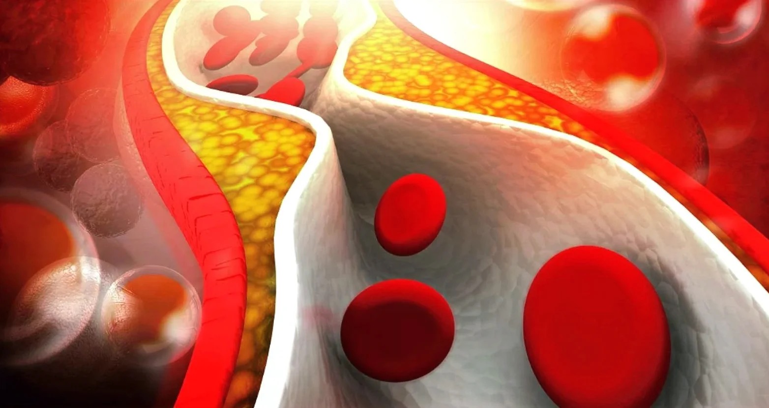  кардиолог липидолог что лечит