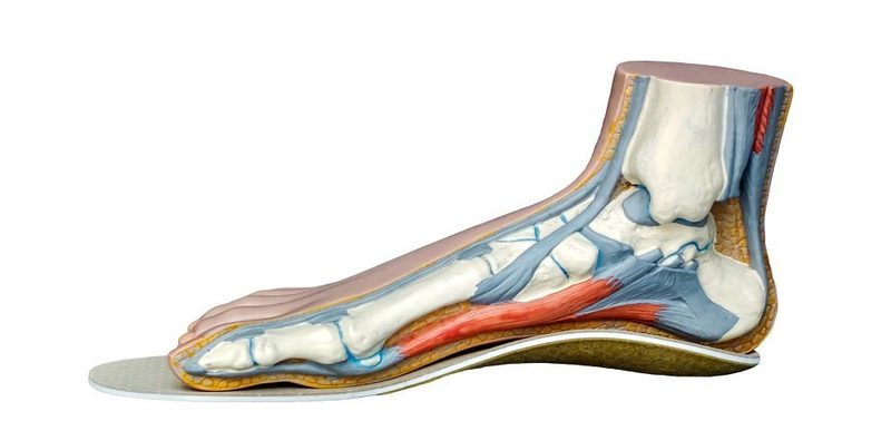 Как выглядят ортопедические стельки фото