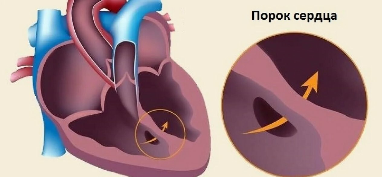 Отчего Сердца Картинки