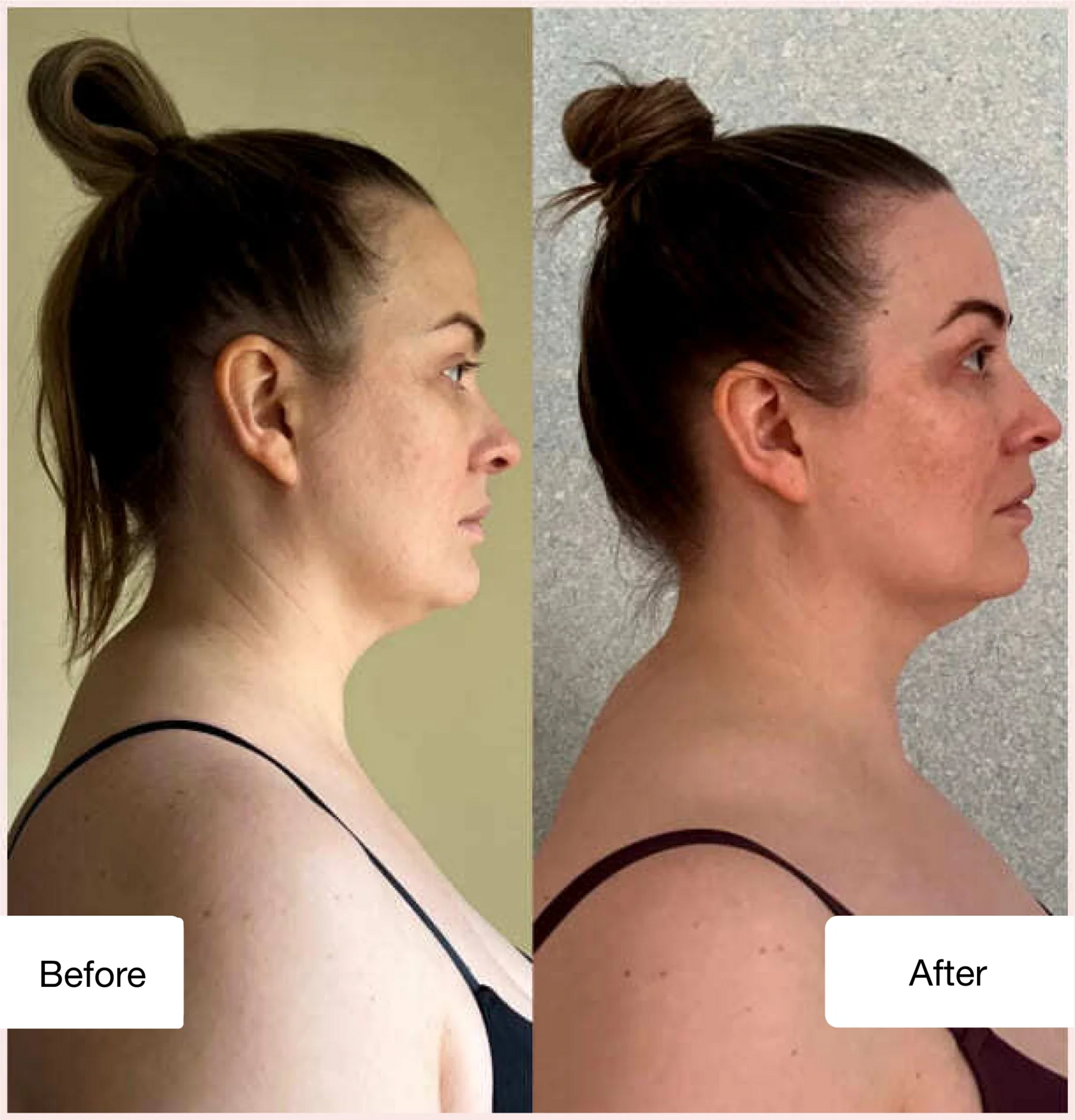 Before and after