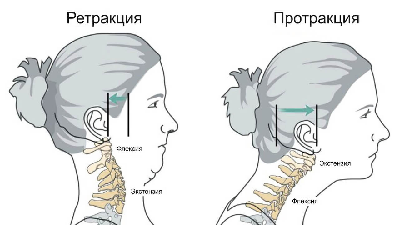 мигрень и головная боль при беременности