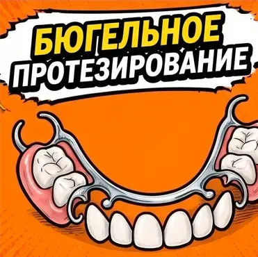 Бюгельный протез