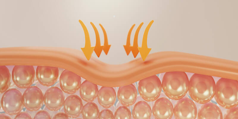 Коллагенотерапия лица и шеи: косметолог вводит инъекции для улучшения упругости кожи и омоложения лица