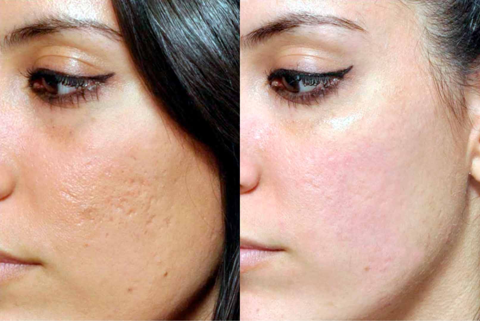 Как восстанавливается кожа