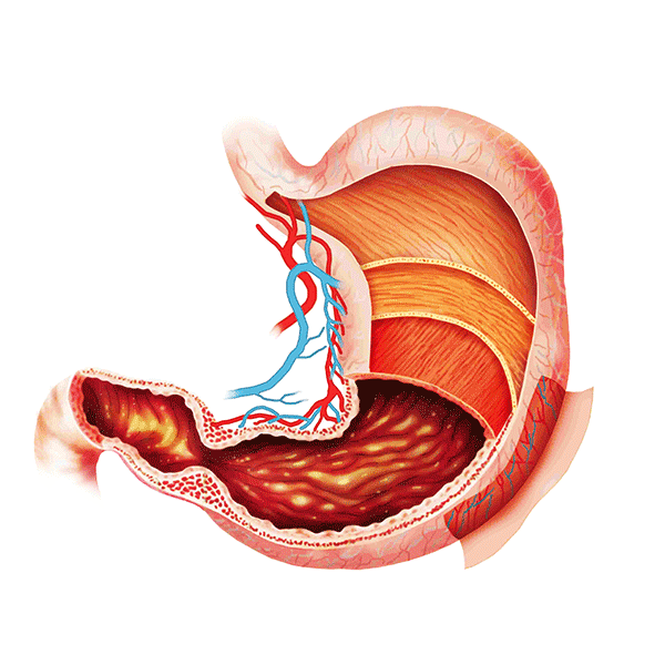Боли в правом подреберье при поражении желудка