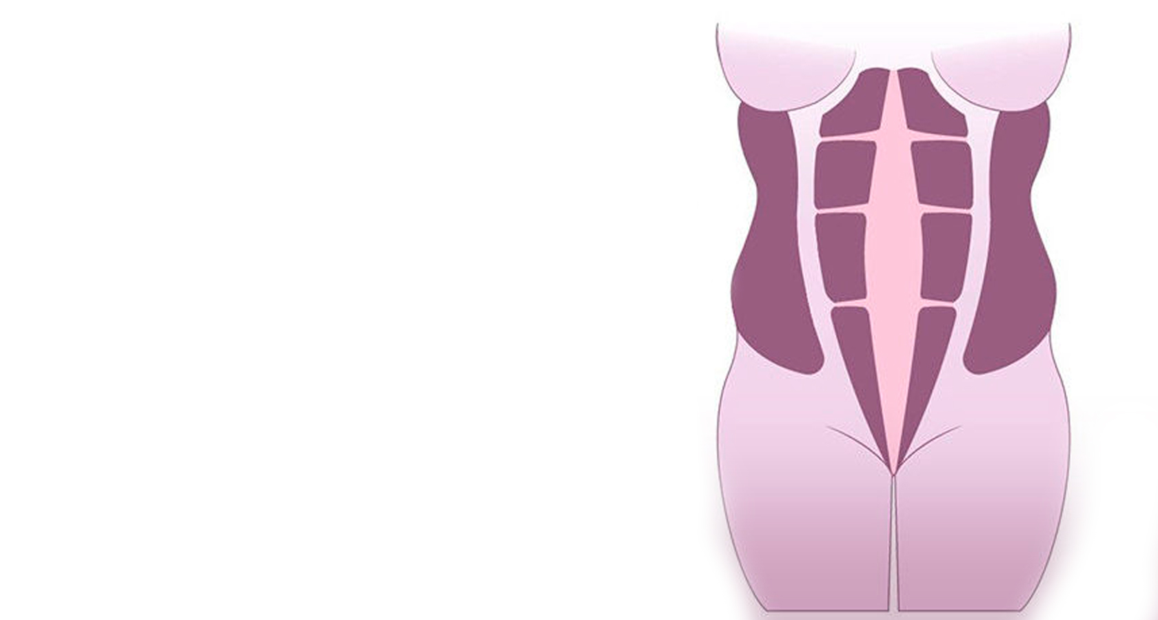 Диастаз. Диастаз абдоминальных мышц. Диастаз мышц живота упражнения. Диастаз брюшных мышц упражнения.