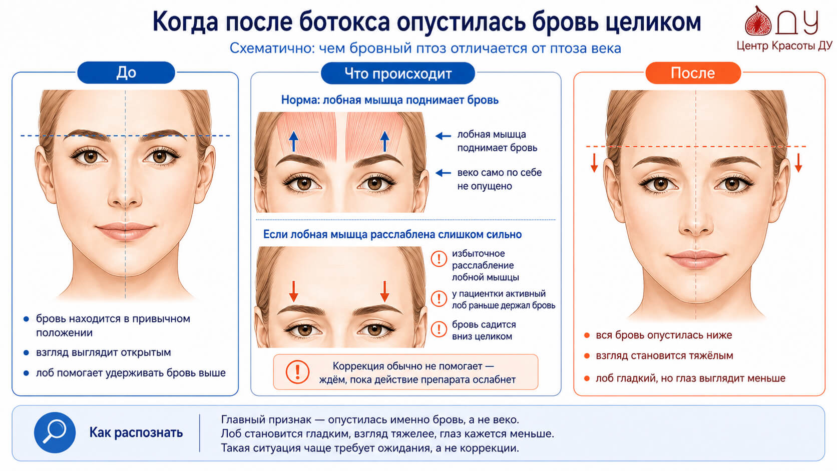 Ботокс Можно Ли Заниматься Сексом Ботокс Можно Ли Заниматься Сексом